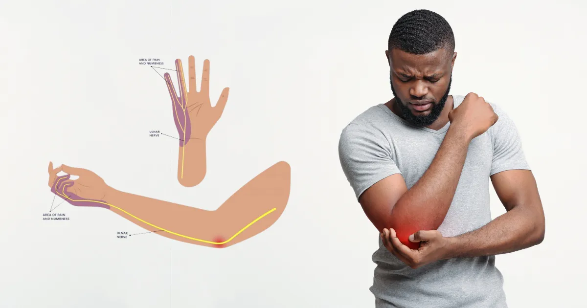 Cubital Tunnel Syndrome Cause Shoulder and Neck Pain