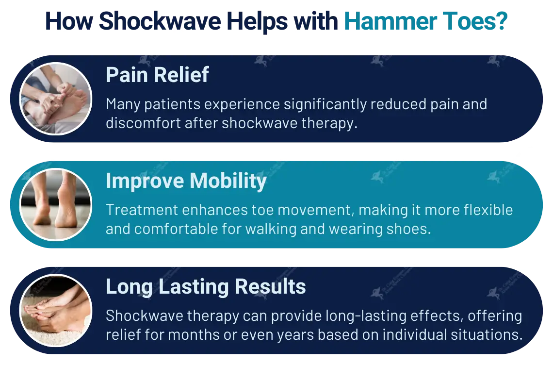 Shockwave Therapy for Hammer Toes: A Non-Invasive Solution