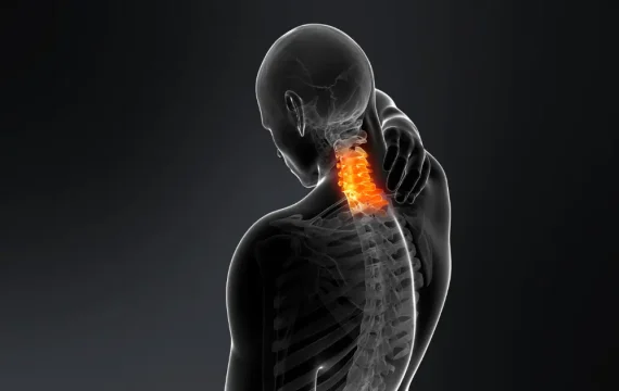 Can Chiropractors Fix Dowager's Hump