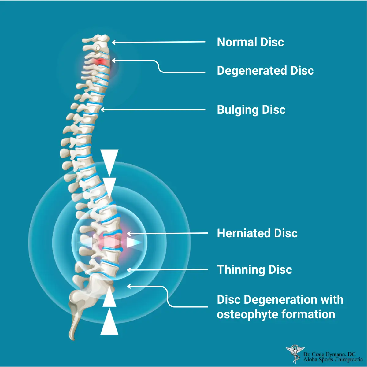 effects of poor posture