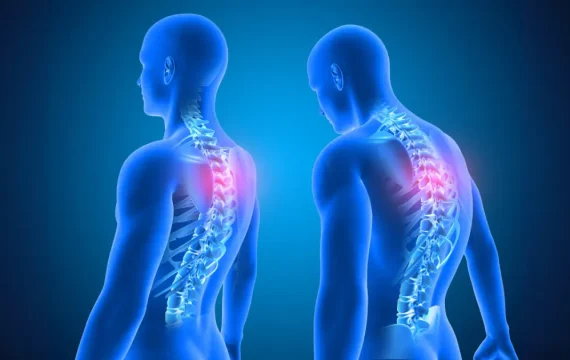 effects of poor posture