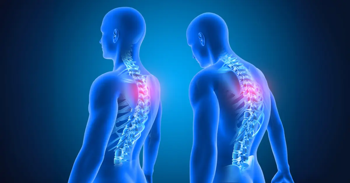 Shocking Effects of Poor Posture: A Must-Read for Better Health