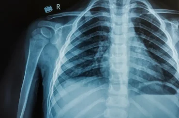 The Critical Link Between Spinal Subluxation and Organ Function